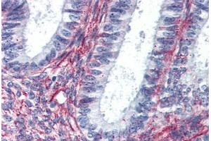 Anti-AGTR2 antibody  ABIN1048323 IHC staining of human uterus.