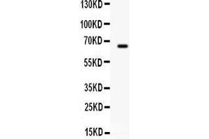 Observed bind size: 66KD (Butyrylcholinesterase anticorps  (AA 263-571))