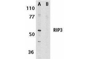 MPRIP anticorps  (AA 473-486)