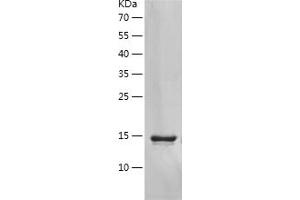 Western Blotting (WB) image for Chemokine (C-C Motif) Ligand 2 (CCL2) (AA 24-99) (Active) protein (His tag) (ABIN7122277)