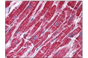 Human Heart: Formalin-Fixed, Paraffin-Embedded (FFPE) (FH anticorps  (Internal Region))