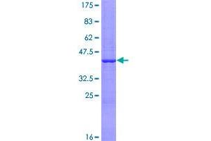 Image no. 1 for Nudix (Nucleoside Diphosphate Linked Moiety X)-Type Motif 16 (NUDT16) (AA 1-162) protein (GST tag) (ABIN1313179)