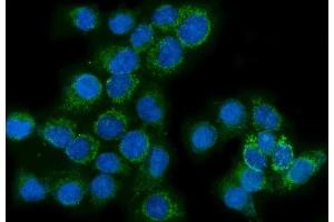 anti-Glutaminase (GLS) (AA 396-654) antibody