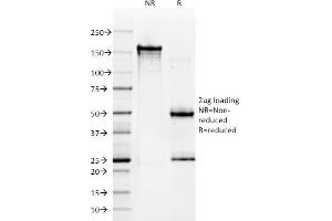 SDS-PAGE Analysis Purified HLA-A Mouse Monoclonal Antibody (108-2C5). (HLA-A anticorps)