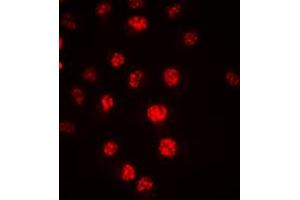 Immunofluorescent analysis of CDC16 staining in HeLa cells.