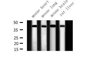 Western blot analysis of ILKAP expression in various lysates (ILKAP anticorps  (N-Term))