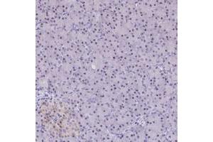 Immunohistochemical staining of human pancreas with C3orf26 polyclonal antibody  shows moderate nucleolar positivity in exocrine glandular cells at 1:200-1:500 dilution. (CMSS1 anticorps)