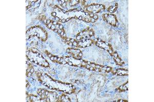 Immunohistochemistry of paraffin-embedded rat kidney using FGD1 antibody (ABIN7267284) at dilution of 1:100 (40x lens). (FGD1 anticorps  (AA 700-800))