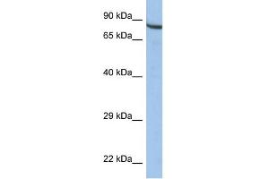 WB Suggested Anti-ZNF630 Antibody Titration:  0. (ZNF630 anticorps  (Middle Region))