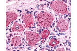 Anti-5HT1D Receptor antibody IHC of human spinal cord, dorsal root ganglion.