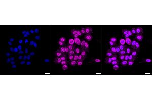 Immunocytochemical staining of HepG2 cells with BCL11 transcription factor B antibody (ABIN7800915), 1:1,000).