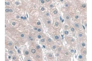 Detection of KATNA1 in Human Liver Tissue using Polyclonal Antibody to Katanin P60 Subunit A 1 (KATNA1) (KATNA1 anticorps  (AA 8-229))
