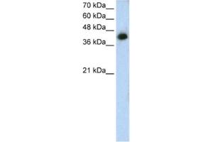 Western Blotting (WB) image for anti-Microtubule Associated Tumor Suppressor 1 (MTUS1) antibody (ABIN2462816)