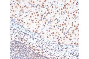 Immunohistochemistry of paraffin-embedded Rat ovary using Phospho-p53(S33) Polyclonal Antibody at dilution of 1:100 (40x lens).