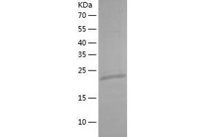 Western Blotting (WB) image for MOB Kinase Activator 3B (MOB3B) (AA 1-216) protein (His-IF2DI Tag) (ABIN7124010)