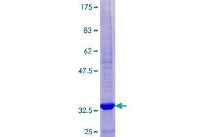 Image no. 1 for High Affinity Immunoglobulin epsilon Receptor Subunit gamma (FCER1G) (AA 1-86) protein (GST tag) (ABIN1353889)