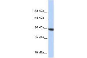 Image no. 1 for anti-KIAA1549 (KIAA1549) (C-Term) antibody (ABIN6747731) (KIAA1549 anticorps  (C-Term))