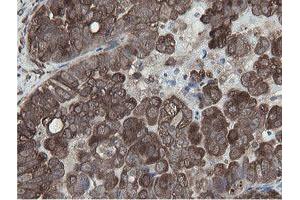 Image no. 9 for anti-Mitochondrial Intermediate Peptidase (MIPEP) (AA 174-516) antibody (ABIN1491015)