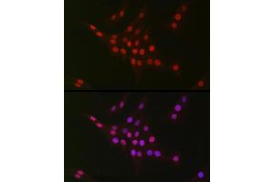 Immunofluorescence analysis of PC-12 cells using CTBP2 Rabbit mAb (ABIN7265979) at dilution of 1:100 (40x lens). (CTBP2 anticorps)
