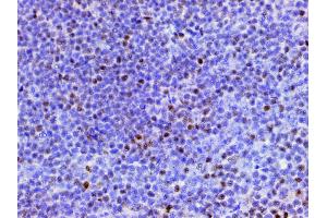 ABIN6267443 at 1/200 staining human appendiceal tissue sections by IHC-P.