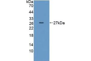 Figure. (TPMT anticorps  (AA 26-227))