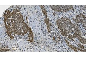 IHC analysis of PARP using anti-PARP antibody (ABIN7602277). (PARP1 anticorps  (AA 670-858))