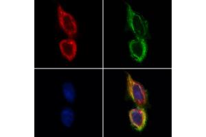 ABIN6265766 and ABIN6268647 staining Hela by IF/ICC. (TSC1 anticorps  (C-Term))