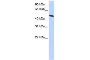 WB Suggested Anti-PDIA6 Antibody Titration: 0. (PDIA6 anticorps  (Middle Region))