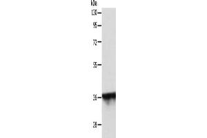 Gel: 10 % SDS-PAGE, Lysate: 40 μg, Lane: MCF7 cells, Primary antibody: ABIN7131160(SPATA2L Antibody) at dilution 1/500, Secondary antibody: Goat anti rabbit IgG at 1/8000 dilution, Exposure time: 30 seconds (SPATA2L anticorps)