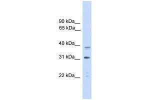 WB Suggested Anti-CEBPA Antibody Titration: 0. (CEBPA anticorps  (C-Term))