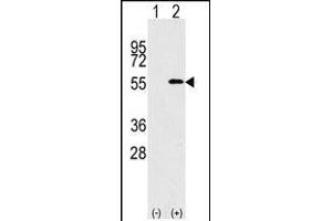 Western blot analysis of NUP50 (arrow) using rabbit polyclonal NUP50 Antibody (C-term) (R).