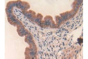 Detection of SLPI in Mouse Uterus Tissue using Polyclonal Antibody to Secretory Leukocyte Peptidase Inhibitor (SLPI)