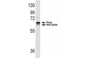 Western blot analysis of p70S6K antibody and TNF alpha activated HeLa lysate