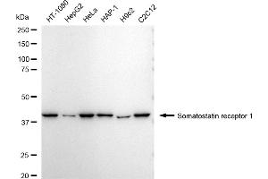 anti-Somatostatin Receptor 1 (SSTR1) antibody