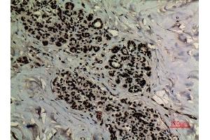 Immunohistochemistry (IHC) analysis of paraffin-embedded Human Breast, antibody was diluted at 1:100.
