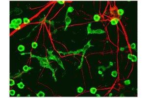 Immunostaining of cultured neurons and glia showing specific labeling of neuronal processes (red) using our alpha-internexin antibody and microglia (green) with a coronin 1a antibody. (INA anticorps)