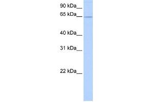 WB Suggested Anti-ZNF526 Antibody Titration:  0. (ZNF526 anticorps  (C-Term))