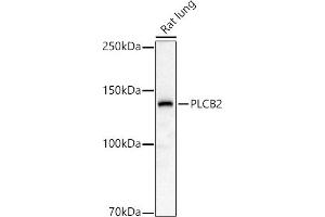 Western blot analysis of extracts of Rat lung, using PLCB2 antibody (ABIN6133052, ABIN6145747, ABIN6145748 and ABIN6224164) at 1:1000 dilution. (Phospholipase C beta 2 anticorps  (AA 1-199))