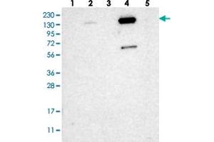 Western blot analysis of Lane 1: RT-4, Lane 2: U-251 MG, Lane 3: Human Plasma, Lane 4: Liver, Lane 5: Tonsil with ZNF629 polyclonal antibody  at 1:250-1:500 dilution. (Zinc Finger Protein 629 (ZNF629) anticorps)