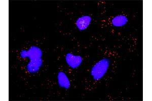 Proximity Ligation Analysis of protein-protein interactions between CASP3 and CDKN1A.