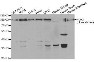 Western Blotting (WB) image for anti-Pyruvate Dehydrogenase Kinase, Isozyme 4 (PDK4) antibody (ABIN6220032) (PDK4 anticorps)