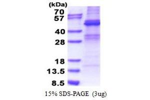SDS-PAGE (SDS) image for Zinc Finger Protein 514 (ZNF514) (AA 1-400) protein (His tag) (ABIN5853307)