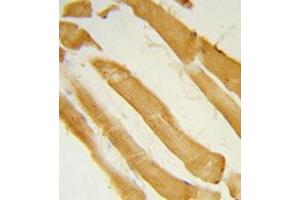 Formalin-fixed and paraffin-embedded human skeletal muscle reacted with ITPKC Antibody (N-term) followed which was peroxidase-conjugated to the secondary antibody, followed by DAB staining.
