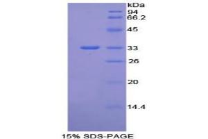 SDS-PAGE analysis of Mouse Integrin beta 1 Protein. (ITGB1 Protéine)