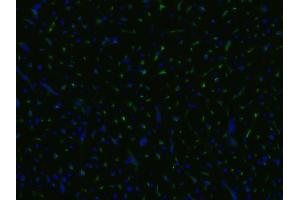 Immunocytochemistry staining of an infarcted porcine heart with anti-CD105 (MEM-229, green), cell nuclei stained with DAPI (blue).