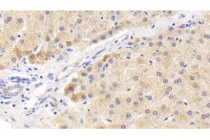 Detection of MAPKAP1 in Human Liver Tissue using Polyclonal Antibody to Mitogen Activated Protein Kinase Associated Protein 1 (MAPKAP1)