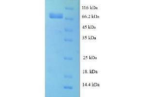 SDS-PAGE (SDS) image for Leucine Rich Repeat Containing 40 (LRRC40) (AA 1-602), (full length) protein (His tag) (ABIN5711891) (LRRC40 Protein (AA 1-602, full length) (His tag))