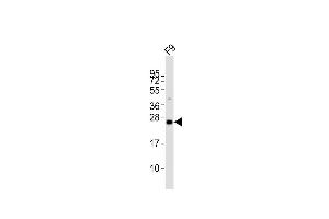 Anti-Lin28a Antibody (C-term)at 1:2000 dilution + F9 whole cell lysates Lysates/proteins at 20 μg per lane. (LIN28A anticorps  (C-Term))