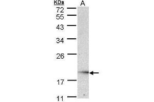 WB Image Sample (30 ug of whole cell lysate) A: Raji , 12% SDS PAGE antibody diluted at 1:1000 (UBE2G2 anticorps)