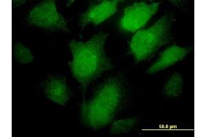 Immunofluorescence of monoclonal antibody to PCSK1 on HeLa cell.